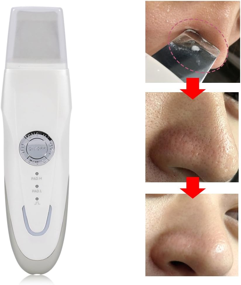 Qiter Skin Scrubber, USB Rechargeable Skin Clean Scrubber Pore Cleaner Facial Exfoliator Beauty Machine