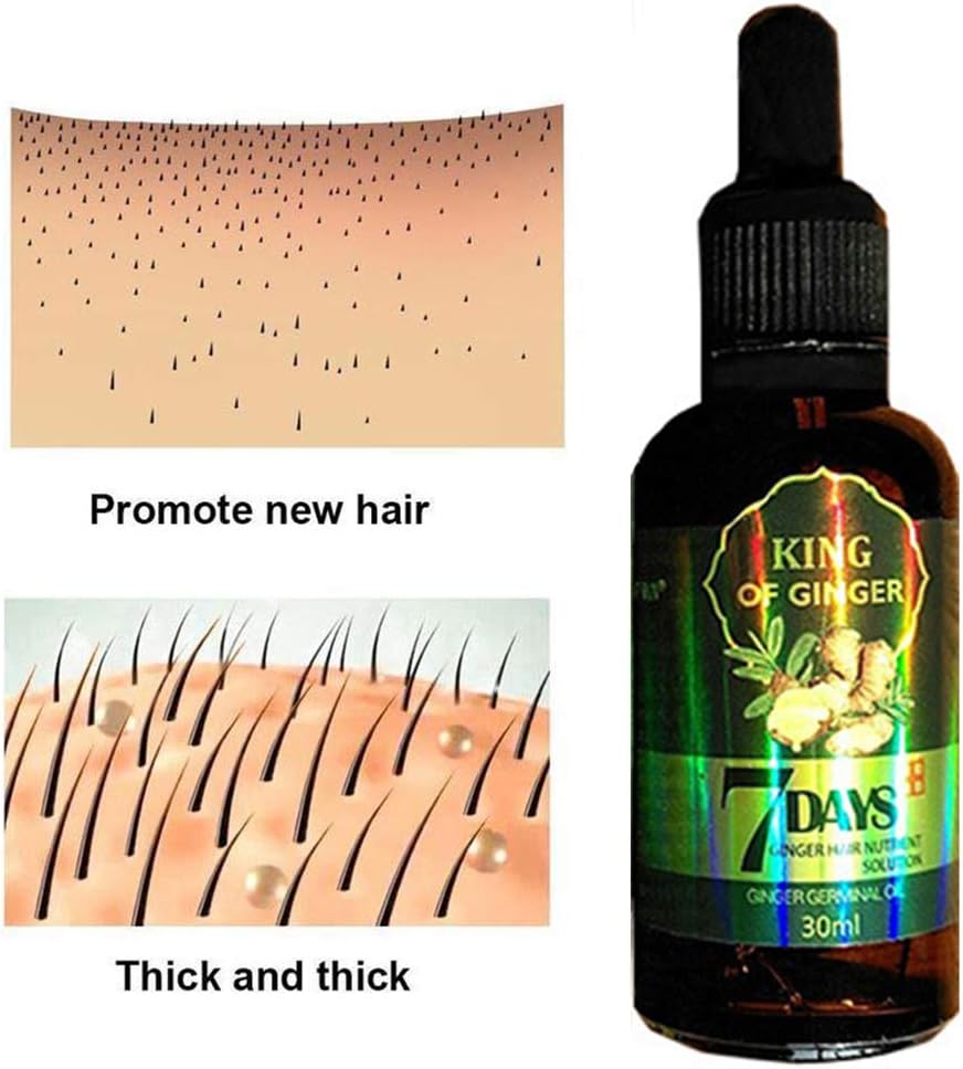 Hair Growth Serum, Hair Care Products, Ginger Hair Serum, Fast Hair Growth & Thickening Oil, Stop Hair Loss, Grow Hair Fast - Image 4