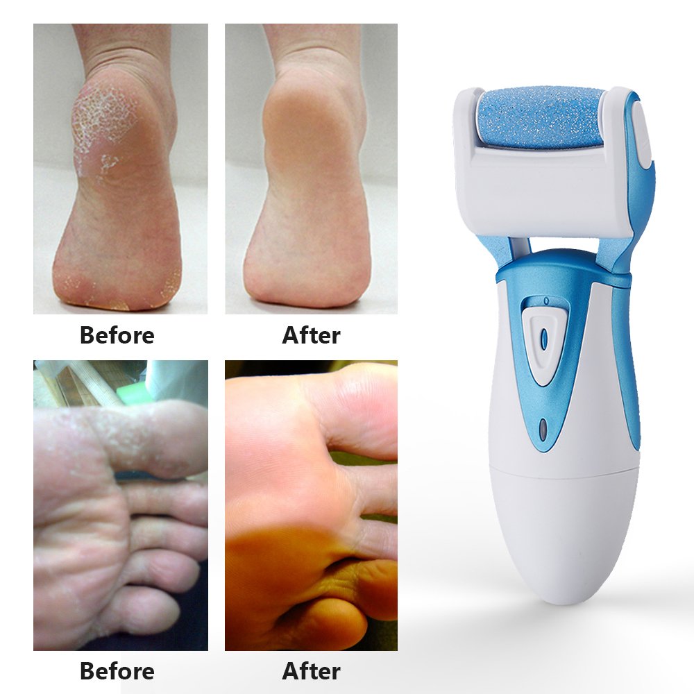 Electric Pedicure Tools - Rechargeable & Waterproof Foot File with Quartz Sand Remove Dead, Hard, Cracked Skin (Blue)