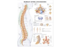ANATOMY STUFF ACC Human Spine Disorders Anatomical Chart