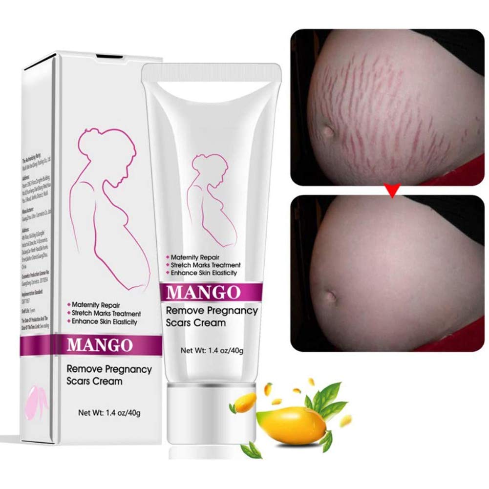 Stretch Mark Cream Treatment, Stretch Marks Scar Belly Creams for Wrinkles, Repair Scar Slack Line Abdomen Postpartum, Obesity Stretch Mark Moisturizing, Remove Marks (M)