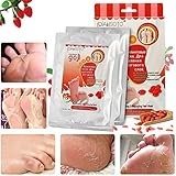 Foot Peel Mask - LuckyFine Wolfberry Repairing Feet Mask, Deep Exfoliation for Dry Dead Skin, Dry Skin Foot Treatment,Make Your Feet Irresistible (2 Pairs per Box)