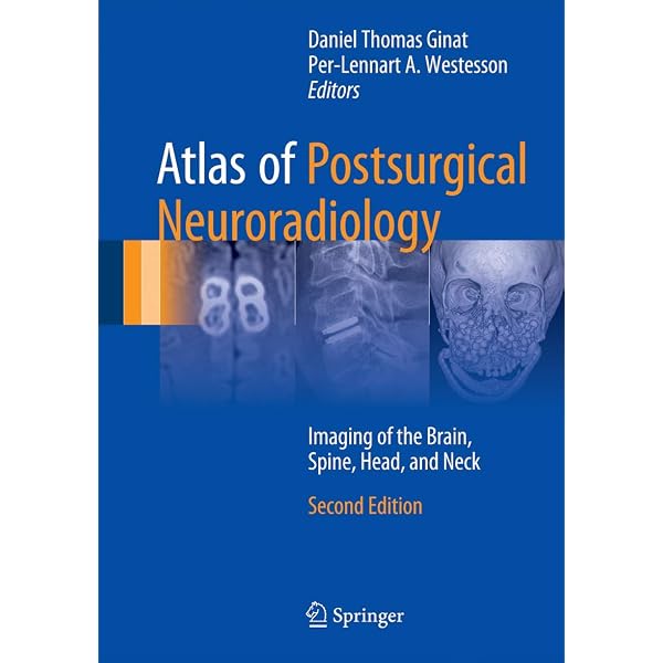 MRI Atlas: Orthopedics and Neurosurgery, The Spine: 9783540335337