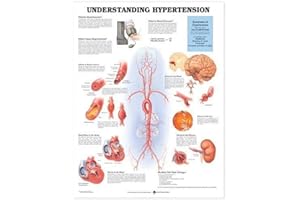 ANATOMY STUFF Understanding Hypertension Chart