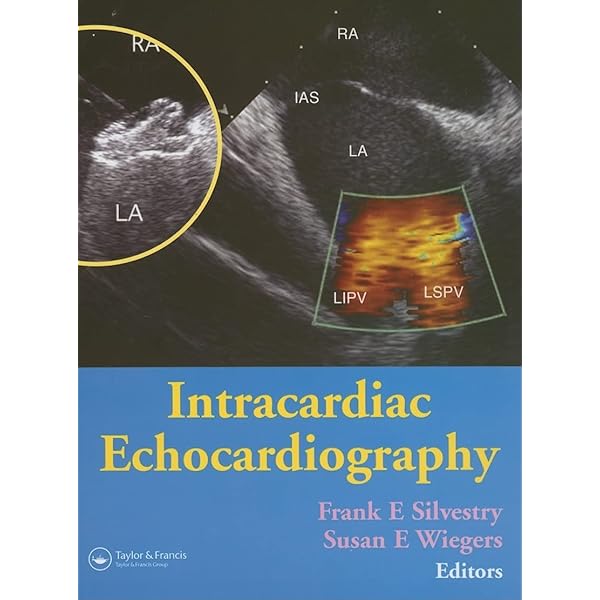 Echocardiographic Anatomy in the Fetus: 9788847005723: Medicine