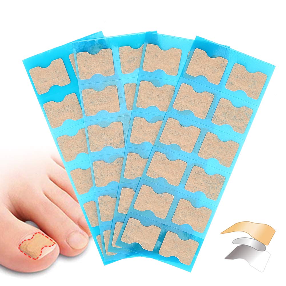 Ingrown Toenail Correction Patch, 4 Sizes Glue-Free Nail File Tool for Toenail Care, Paronychia Treatment Pedicure Aid, Toe Nail Straightening Stick Patch