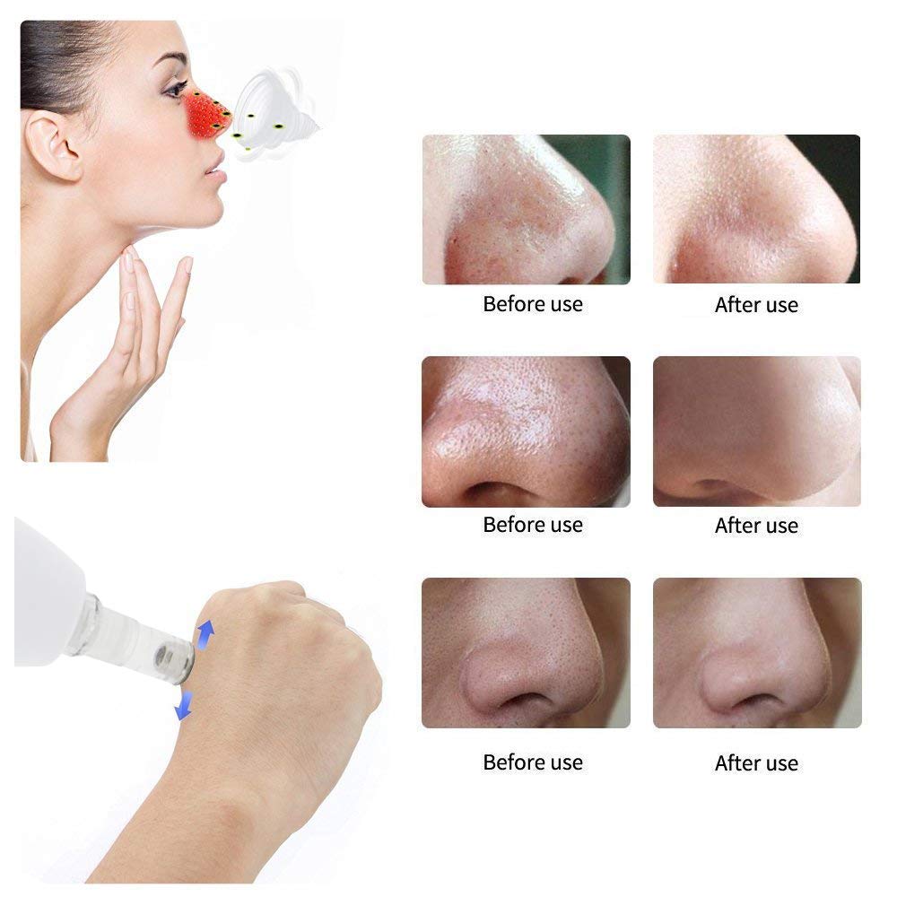Portable Diamond Peeling Facial Pore Cleanser Diamond Microdermabrasion Pen Vacuum Blackhead Removal Machine: Beauty