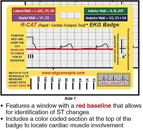 EKG Concepts - Case Study Chronicles 7