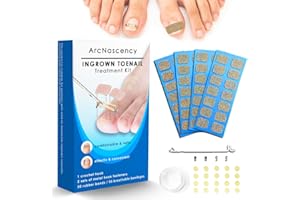 ArcNascency Ingrown Toenail Treatment Corrector & Remover for In Grown Toe Nail Outgrow for Ingrown Toenails