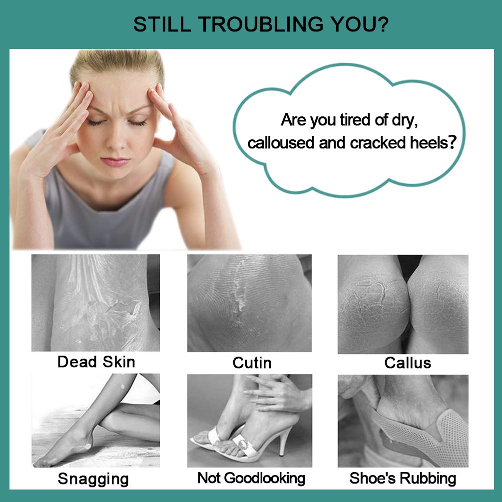 CAREHOOD Foot File Callus Remover - Multi Purpose 4 in 1 Feet Pedicure Tools with Foot Scrubber, Pumice Stone, Foot Rasp and Sand Paper for Home Foot Care (Grey Pedicure Foot File) : Beauty