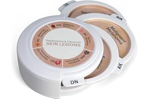 GPI Anatomicals - Skin Cancer Model, Replica with Precancerous and Cancerous Skin Lesions for Human Anatomy and Physiology Education, Anatomy Model for Doctor's Office, Medical Learning Resources