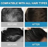 Lophe Professional Hair Building Fibers Brown for Thinning Hair Hair Thickening view 5