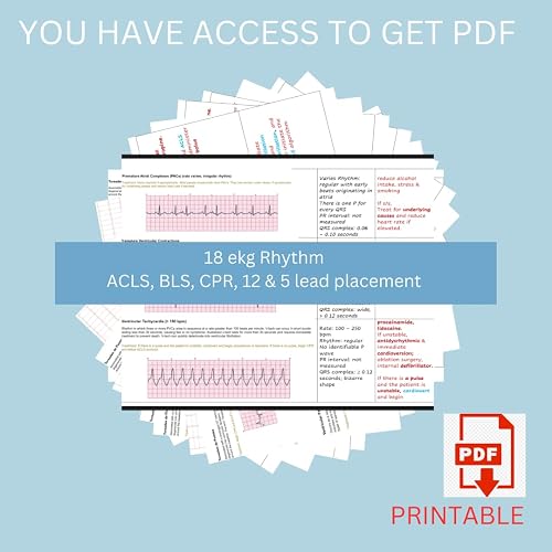 STEMI 12 Lead EKG Reference Badge Card - Electrode Placement Guide For Nurses, EMTs, & Healthcare Pros