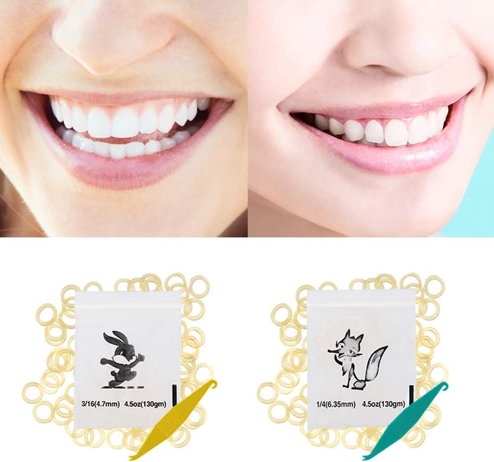 Orthodontic Elastic Bands,500Pcs Dental Orthodontic Elastics Latex