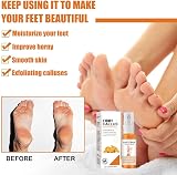 GFOUK Foot Callus Removal Spray 30ml Dead Skin Exfoliating Feet (3PC) view 5