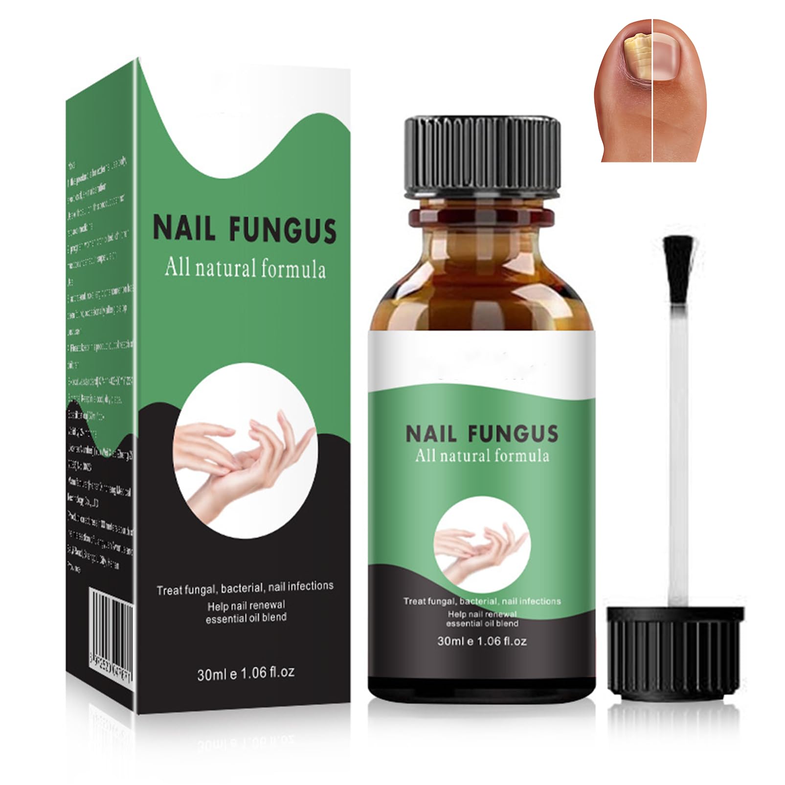 Fungal Nail Treatment - Extra Strong Nail Fungus Treatment for Toenail and Fingernail - Anti fungus Nail Repair and Strengthen, Fix & Renew Damaged, Broken Nails Restoring Healthy Nails-30ml