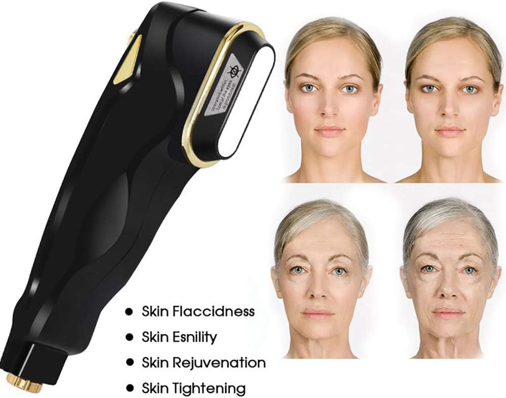 macchina ad ultrasuoni per il viso