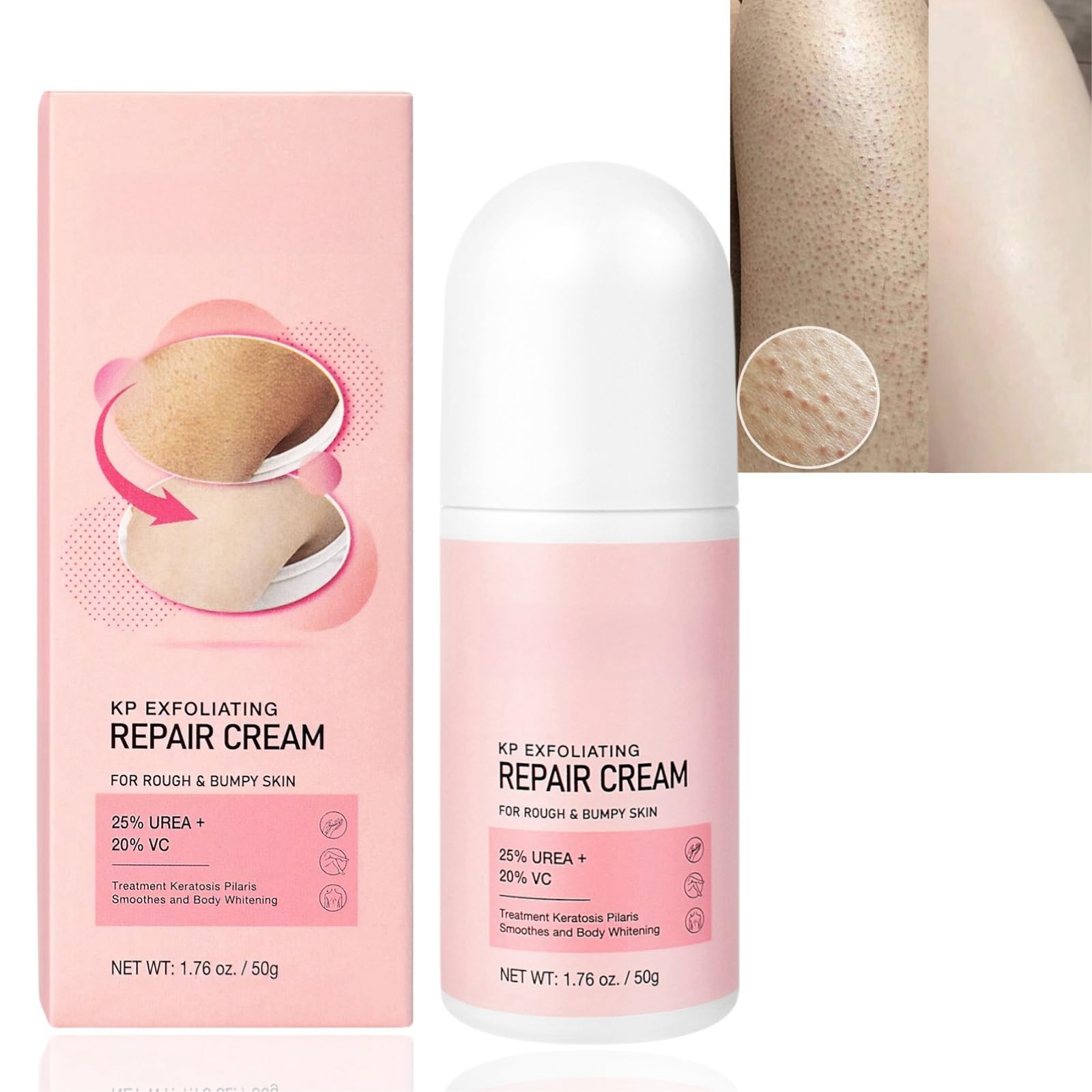 Skin Exfoliating Repair Cream,Chicken Skin Care Cream,Strawberry Legs Treatment Body Cream