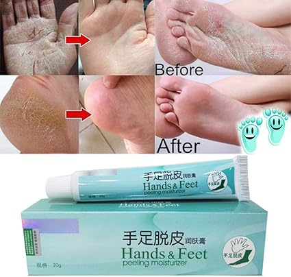 Powerful Hand Foot Crack Cream Heel Chapped Peeling Foot And Hand Repair Anti Dry Crack Skin Care Chinese Ointment By Balai Amazon Co Uk Beauty