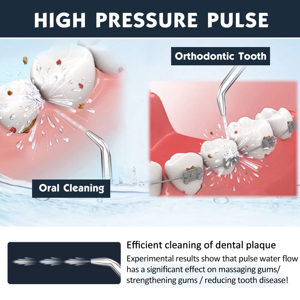 Water Flosser Cordless Teeth Cleaner, Professional Wate Flosser Oral Care for Braces Bridges Care IPX7 Waterproof Dental Flosser with 4 Interchangeable Jet Tips, Detachable Water Tank for Home Travel: Beauty