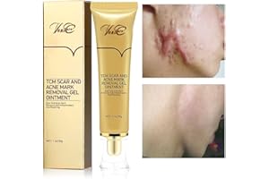 Acne Scar Removal Cream Stretch Marks Face Skin Cream Shrink Pores Gel-Fade Scar Marks Acne Skin Care (Packaging Upgrade) VeniCare