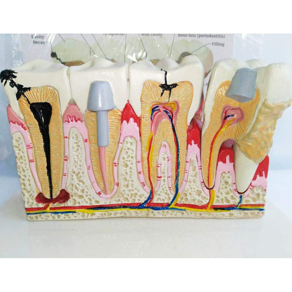 WPY Standard Teeth Model, Standard Study Teaching dental mode with Removable Teeth