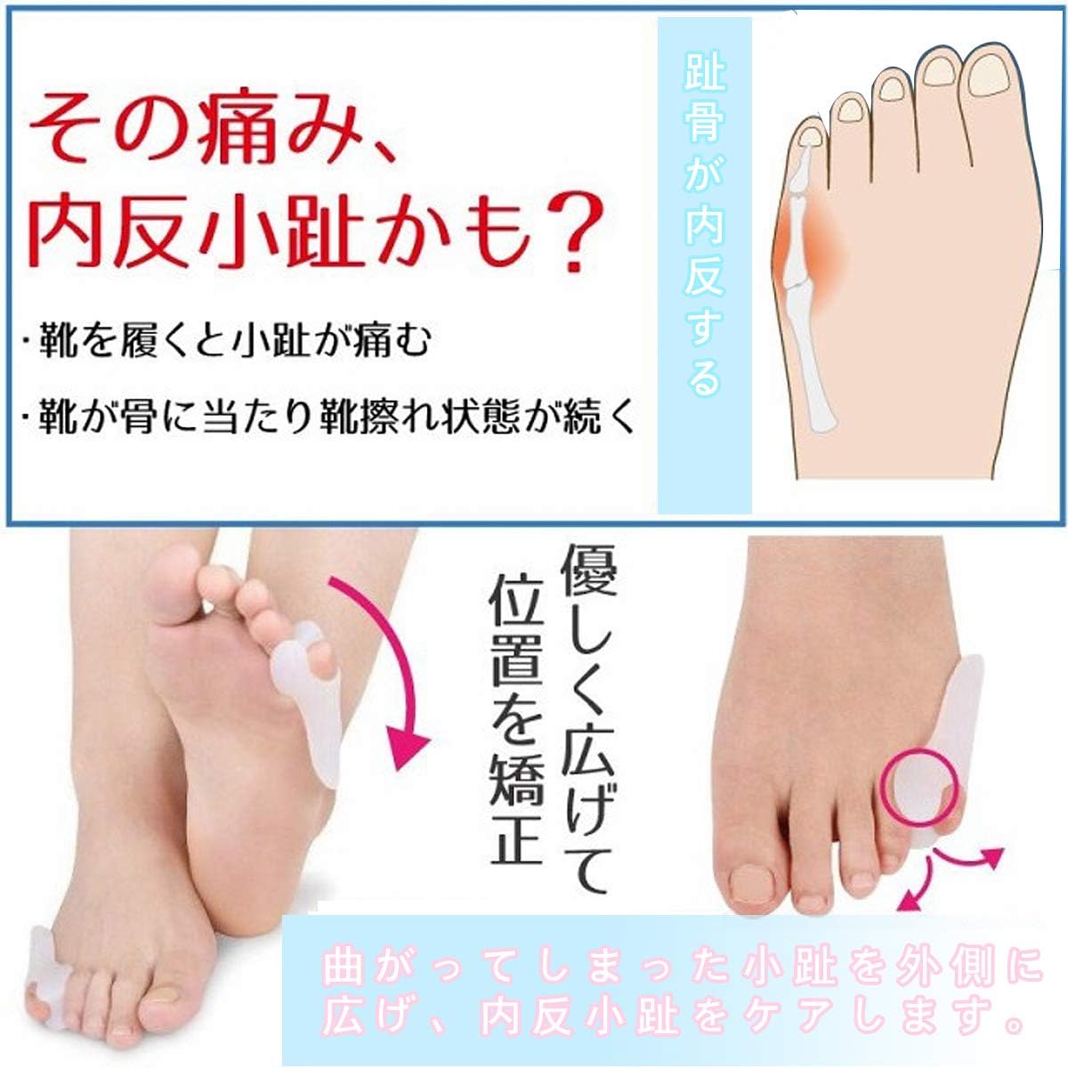 Amazon Tisselly 内反小指 サポーター 矯正 シリコン 足 小指 足指 広げる グッズ パッド ないはんしょうし 痛み止め 洗える 男性用 女性用 靴 靴下 固定 両足 ホワイト Tisselly 外反母趾 内反母趾用