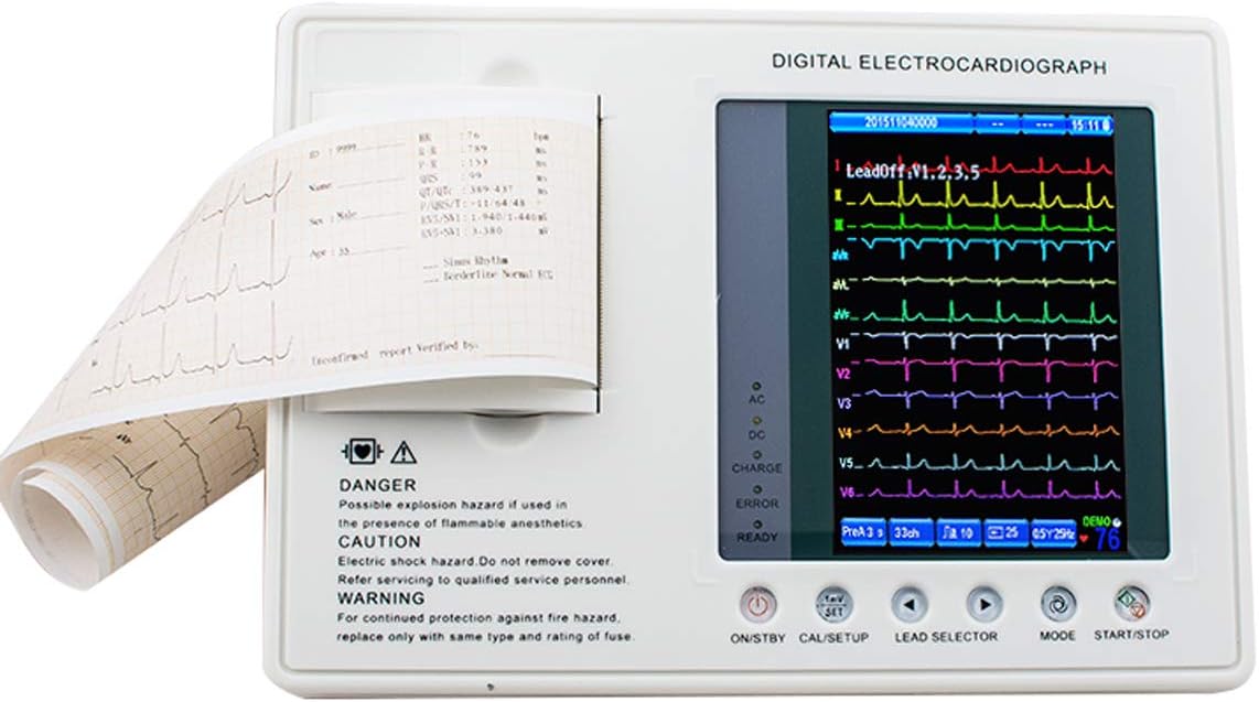 funwill 7 inch Color Multi-Parameter 12-Lead 3-Channel Monitor,903A3,White (Shipping from USA)…
