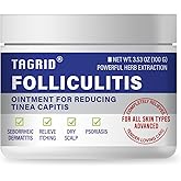 TAGRID Folliculitis Cream, Ingrown Hair, Soothing Scalp, Face & Body Cream - Hydrating & Refreshing - 100g