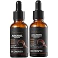 Black Sesame Hair Growth Serum, Black Sesame Black Rice & Rosemary Water Spray,Black Sesame Oil for Hair, Black Sesame Hair Serum (2pcs)