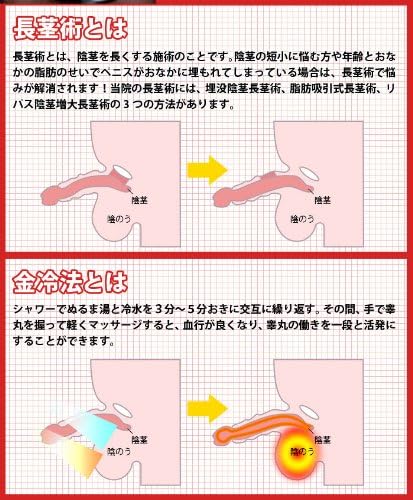 ち ン この 長 さ