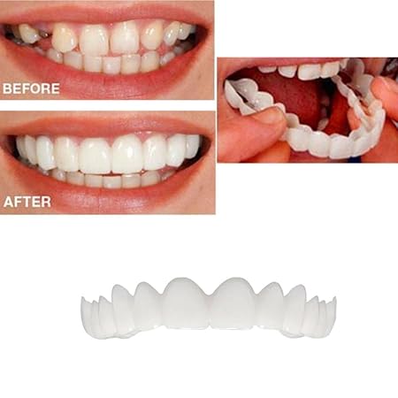 huichang Perfect Smile Zahnersatz Komfort Fit Flex - Die Unglaublichen und sofortigen wiederverwendbaren und Abnehmbaren Vene
