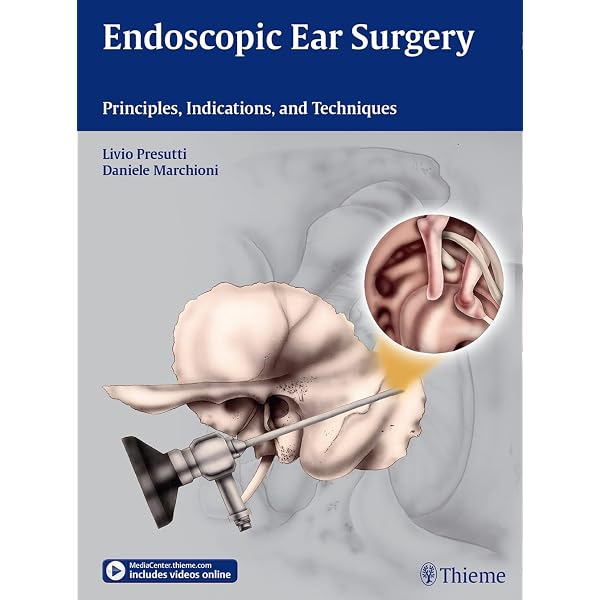 Endoscopic Ear Surgery: Principles, Indications, and Techniques