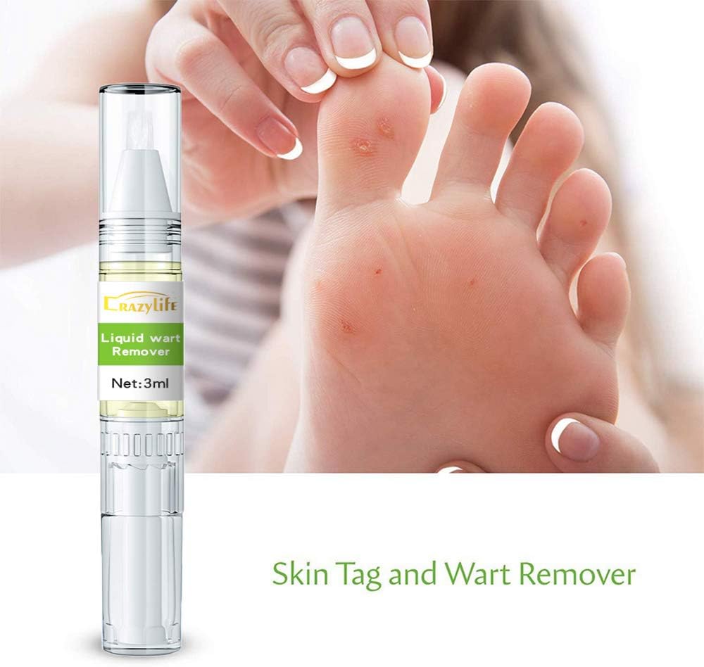 Skin Tag Remover Wart Remover for Neck Quickly Tag Mole Remover for Common and Plantar Warts,2pcs: Health & Personal Care