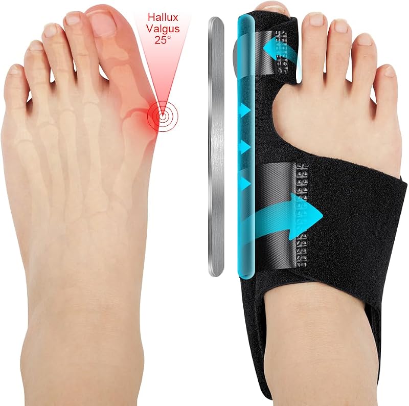 ACWOO Bunion Corrector Set for Women and Men with 2 Splints & 2 Toe