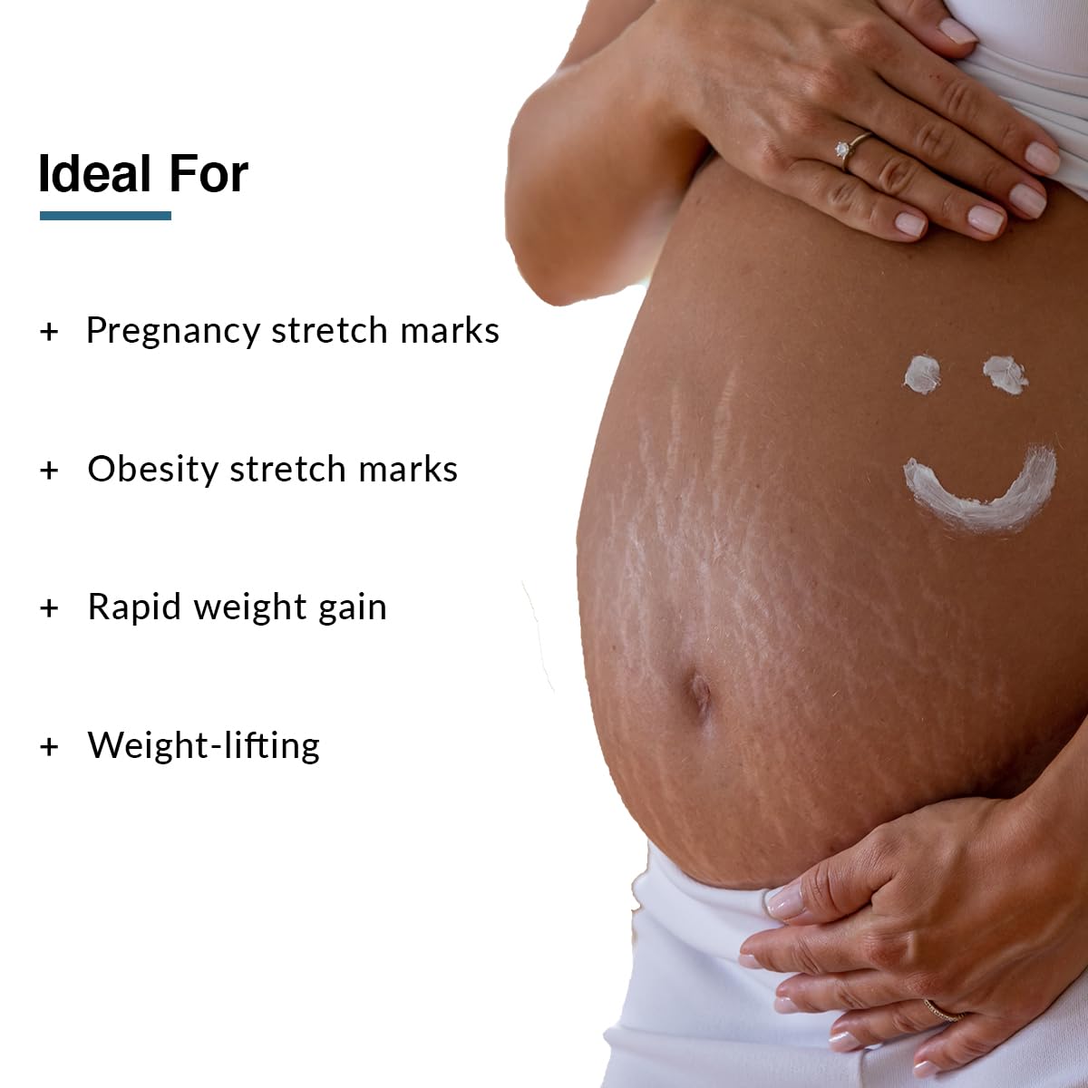 Fixderma Strallium Anti Stretch Mark Cream with 10% Aloe Vera Gel | Stretch Mark Cream | Stretch Mark Cream for Pregnancy | Stretch Mark Remover - 2.64 Oz