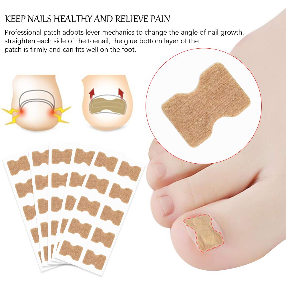 DKAF 5 Sheets Glue Free Toenail Patch with 1 Pcs Nail Hook, Ingrown Toenail Removal Correction Patch Foot Nail Treatment Tool, Toenail Correction Sticker: Beauty