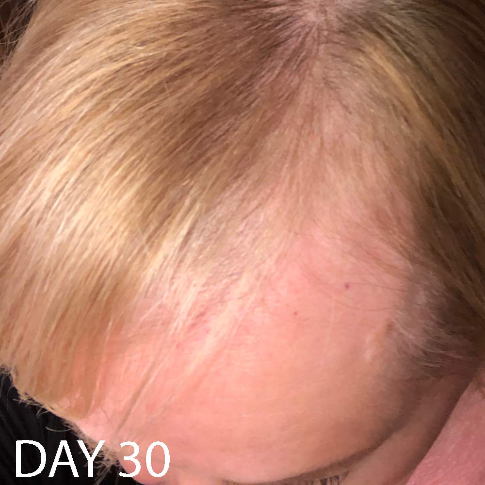 Biotin Vitamin Hair Growth Conditioner-(High Potency) Biotin Conditioner For Fastest Hair Growth, Anti Hair Loss Conditioner, Vitamins E, A, And C, B. THE PRODUCT: Beauty