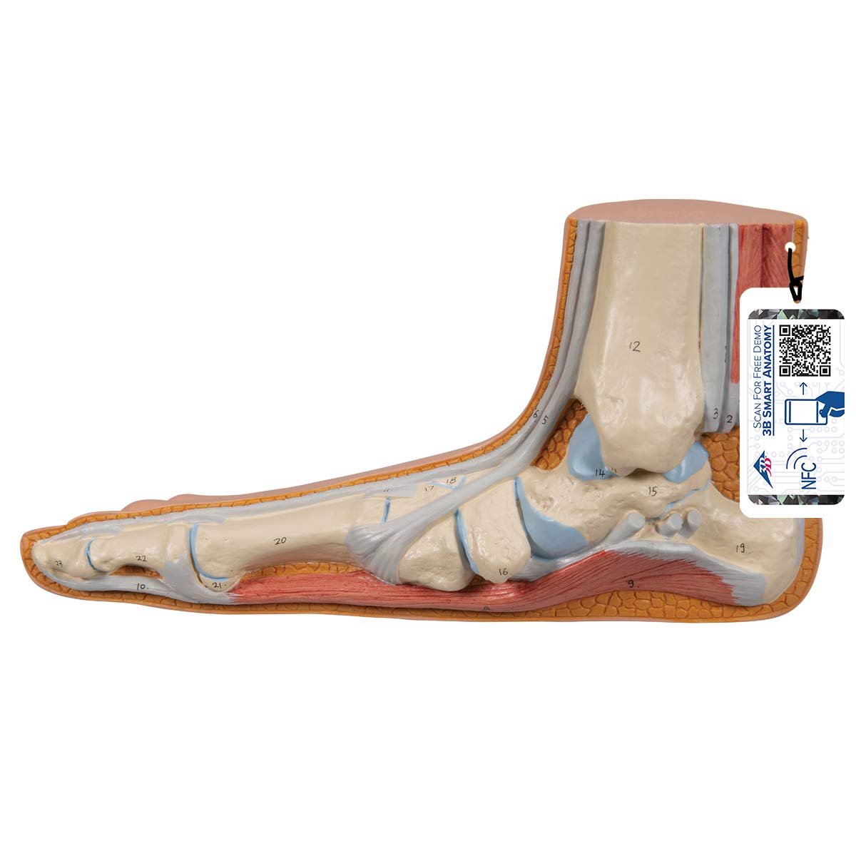3B Scientific M31 Flat Foot, Pes Planus + free anatomy software - 3B Smart Anatomy