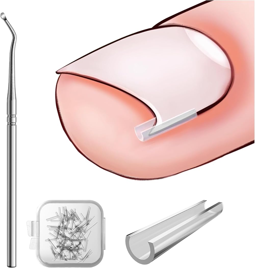 BEZOX Ingrown Toenail Corrector Set 40 Pcs Pain-Free Toenail Strips