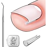 BEZOX Ingrown Toenail Corrector Set - 40 Pcs Pain-Free Toenails Straightener Strips with Toe Nail Lifter - Easy Use Ingrown T