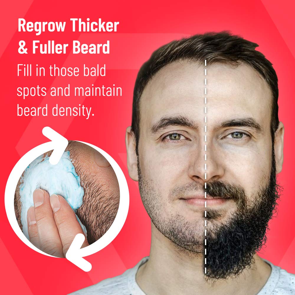 Regenivade Men's 5% Minoxidil + Bioton Topical Foam (3 Month Supply) - Unscented Topical Aerosol - Extra Strength for Men (Minoxidil Serum Pack) : Beauty