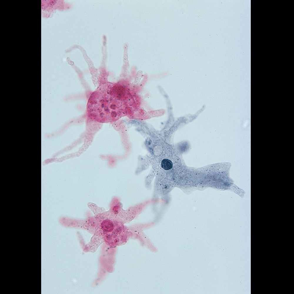 Amoeba Proteus Slide W M Microscope Sample Slides Amazon Com Industrial Scientific