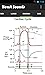 Heart Sounds (+ Lung Sounds)