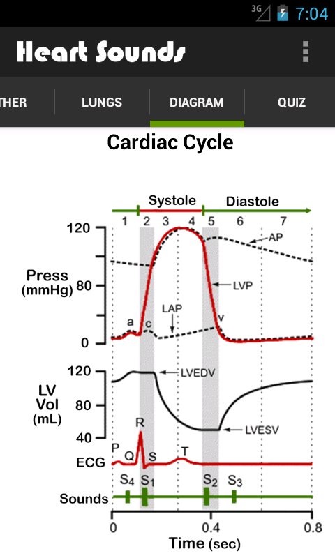 Heart Sounds (+ Lung Sounds)