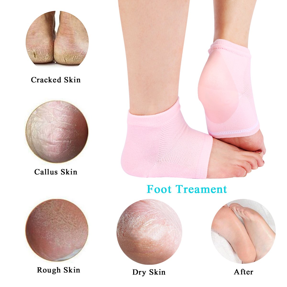 YOTURO 2 Pairs Vented Moisturizing Gel Heel Socks for Dry Hard Cracked Heels Open Toe Comfy Recovery Socks Foot Treament Day Night Care Pink and Green … : Beauty