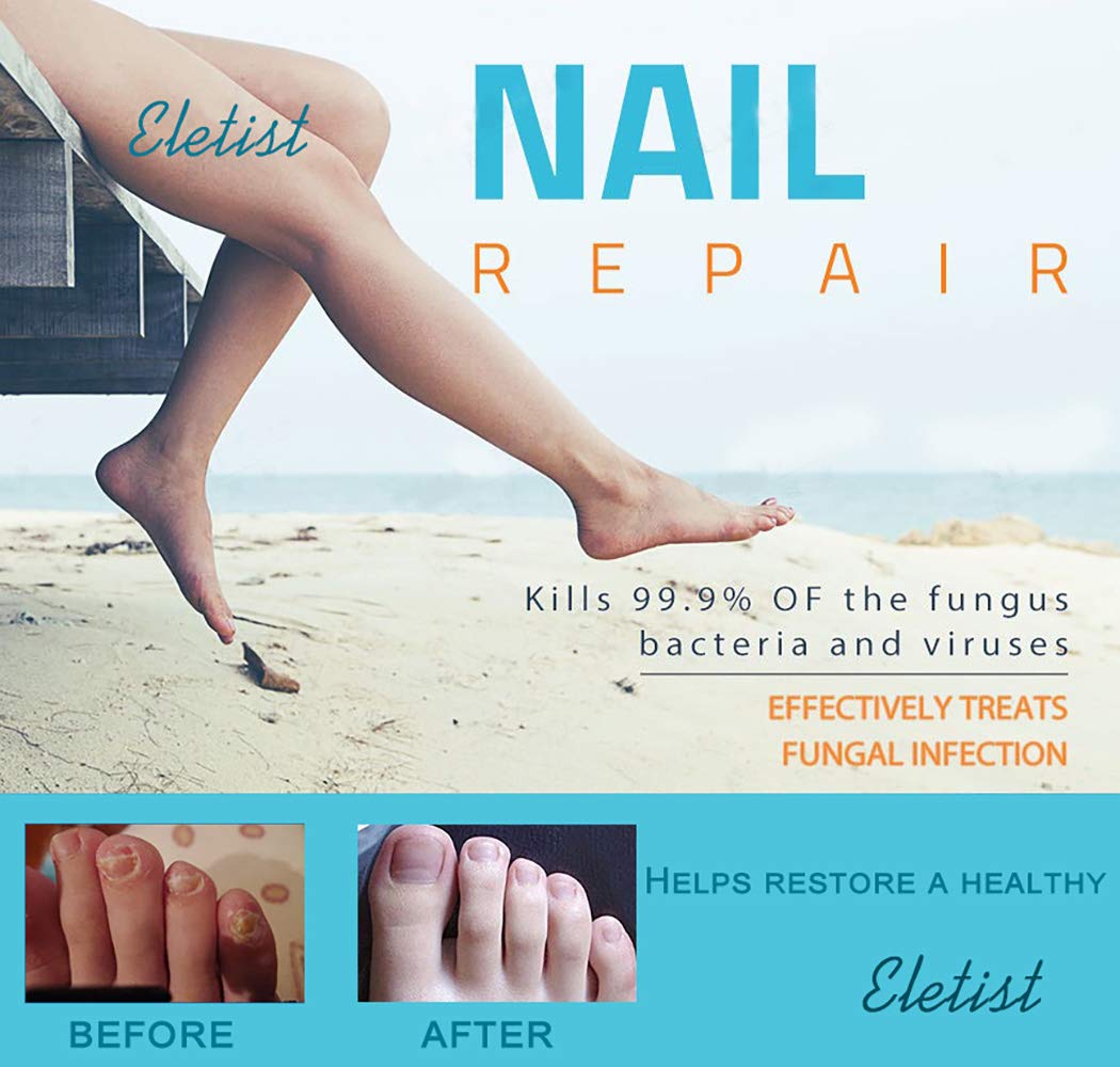 Eletist Nail Repair Pen Nail Fungus Treatment for Toenail Fungus Toenail and Nail Care Solution for Fixes and Restores Discolored and Damaged Nails : Beauty