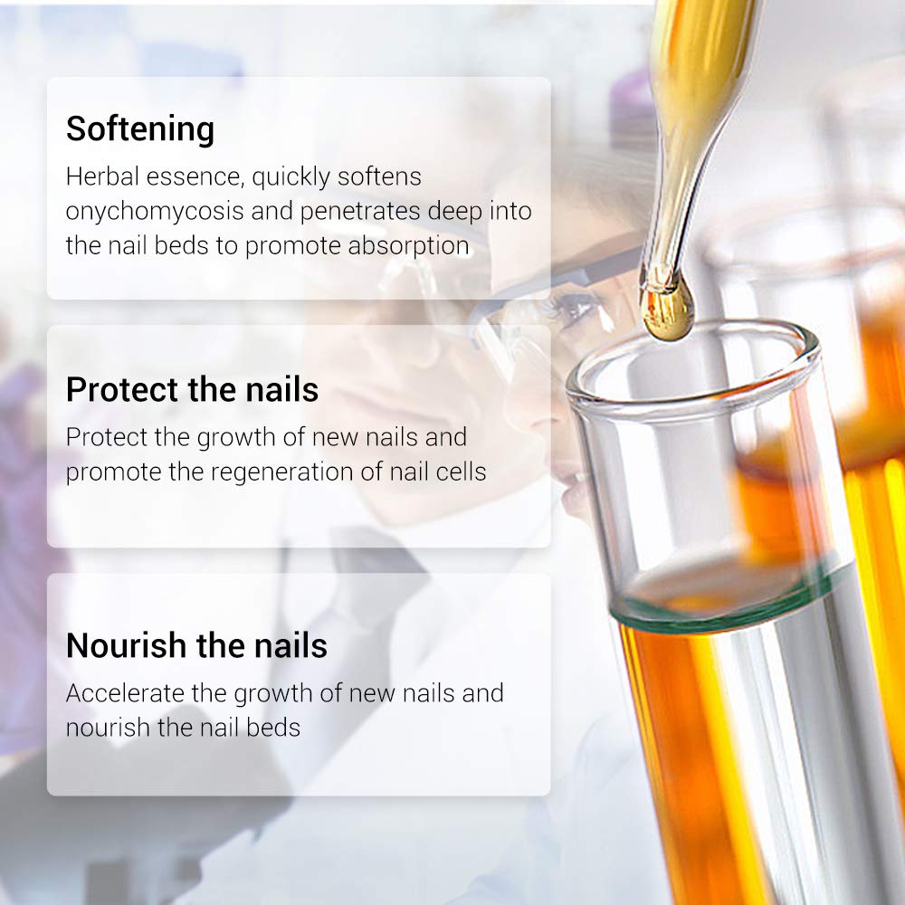 Nails Repair, LANBENA Nail Treatment Nail Care Serum Protect Nail from Damage Fingernail and Toenail Repair for Curing Athlete's Foot and Prevent Nail from Infection Discolored & Damaged Nails(12ml) : Beauty