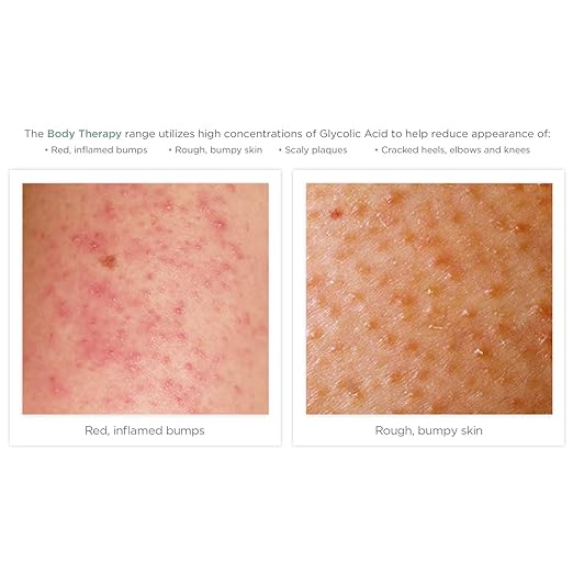 glytone exfoliating body wash with glycolic acid