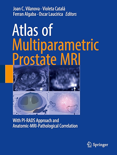 Download Atlas of Multiparametric Prostate MRI: With PI-RADS Approach and Anatomic-MRI-Pathological Correlation (English Edition) PDF